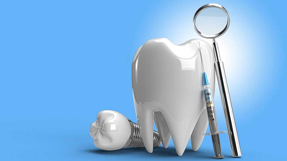 Dental Implants San Diego