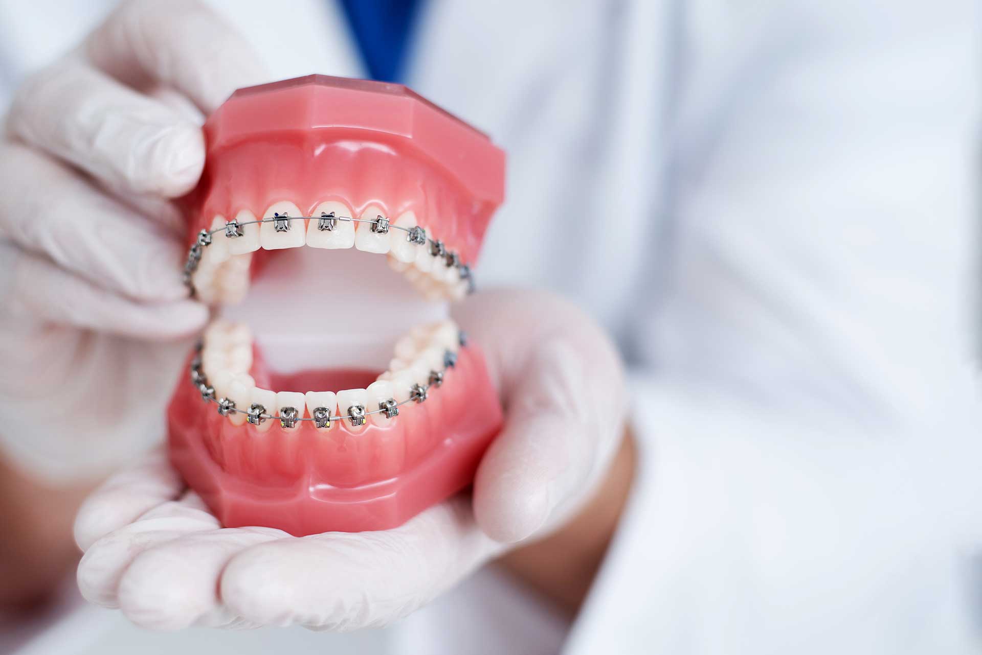 Comparing Dental Braces and Clear Aligners: Which One's Right for You?